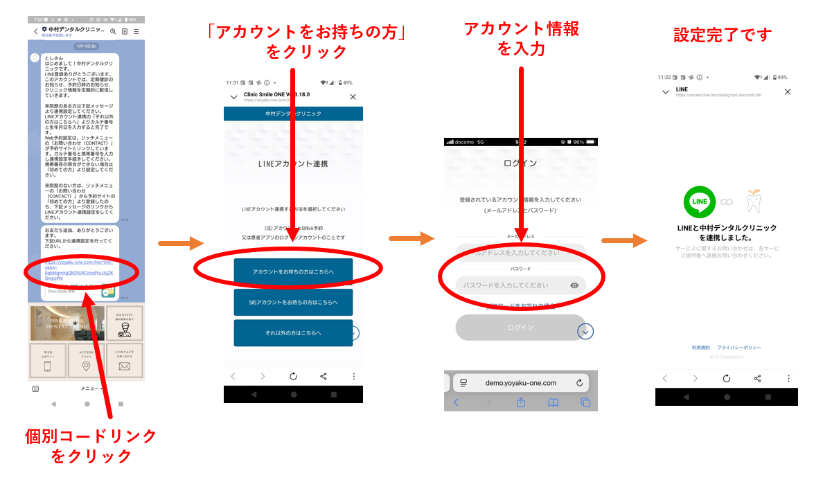 インプラント